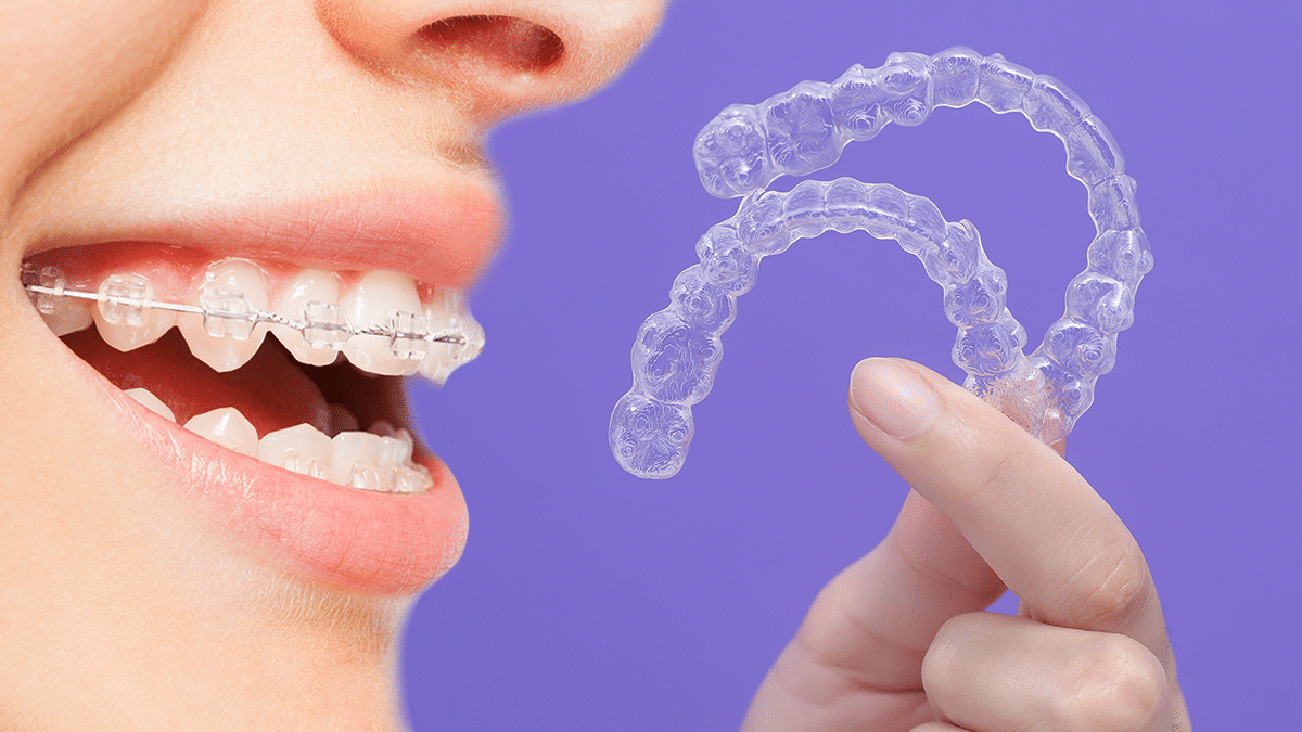 Invisalign vs. Braces